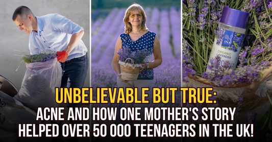 ACNE and how one mother's story helped over 50 000+ teenagers in the UK!