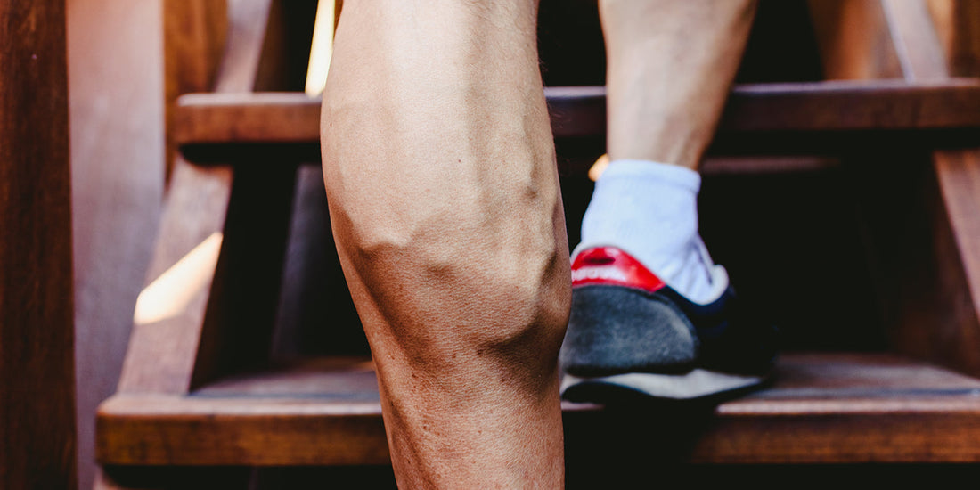 varicose veins and exercise