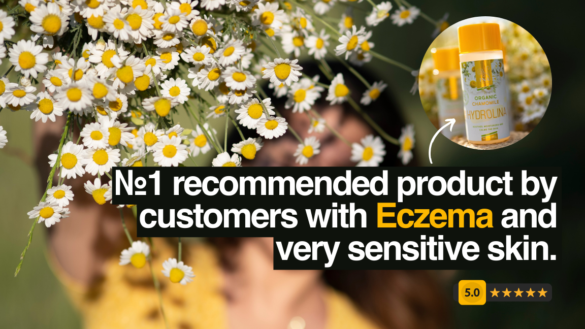 Eczema: a natural product that really helps and 5 reasons to choose it