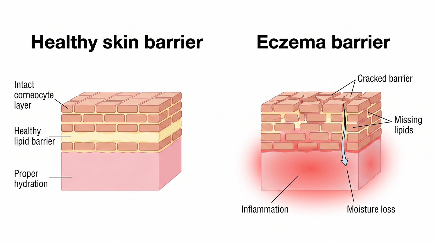 skin_barrier